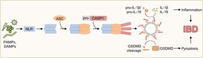 Dysregulated inflammasome activity in intestinal inflammation – Insights from patients with very early onset IBD